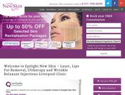 Epilight New Skin Clinic