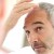 Your guide to hair transplant surgery